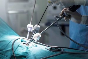 WHAT-IS-LAPAROSCOPY