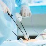 Philosophy of Laparoscopy